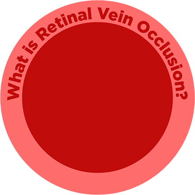 RVO_PWhat-is-RVO_Icon